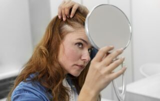 Thinning Hair